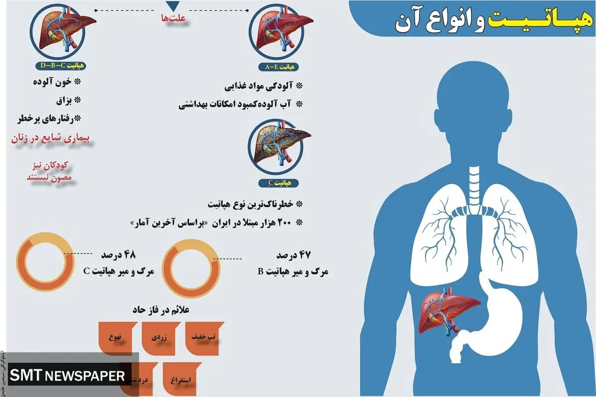 هپاتیت و انواع آن 
