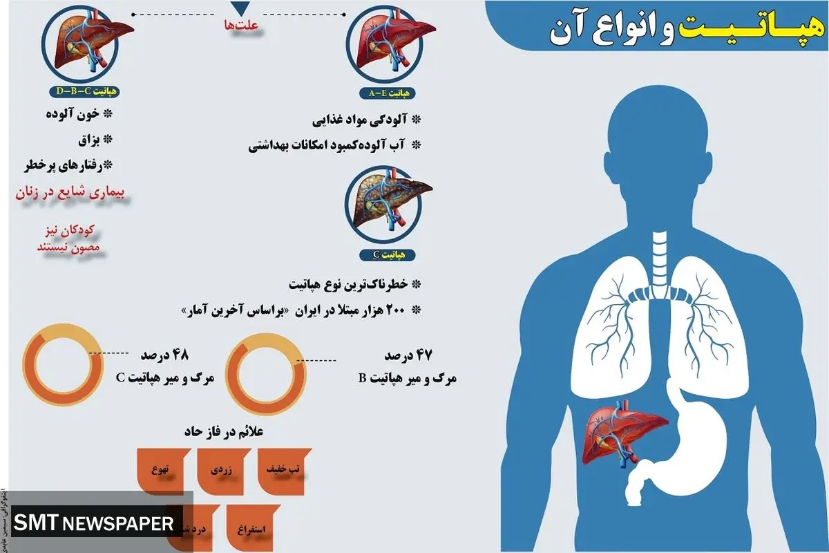 هپاتیت و انواع آن 