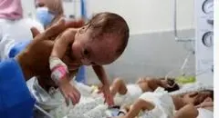 غزه با کاهش بی‌سابقه تولدها و افزایش سقط جنین روبه‌رو شد