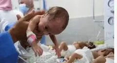 غزه با کاهش بی‌سابقه تولدها و افزایش سقط جنین روبه‌رو شد
