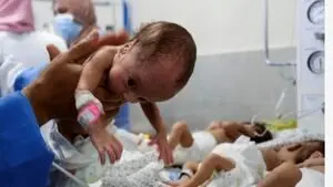 غزه با کاهش بی‌سابقه تولدها و افزایش سقط جنین روبه‌رو شد