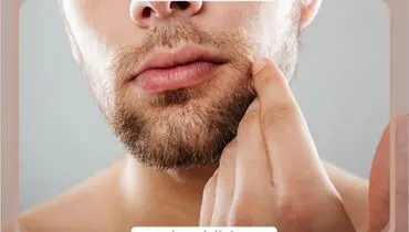 کاشت ریش ؛ راه‌حلی دائمی برای ریش‌های کم‌پشت و ناهماهنگ، جذاب‌تر از همیشه!