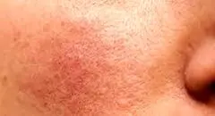 کمبود این ویتامین باعث چین و چروک صورت و خستگی می شود
