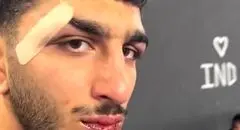 شکست تلخ دانیال سهرابی با خونریزی چانه