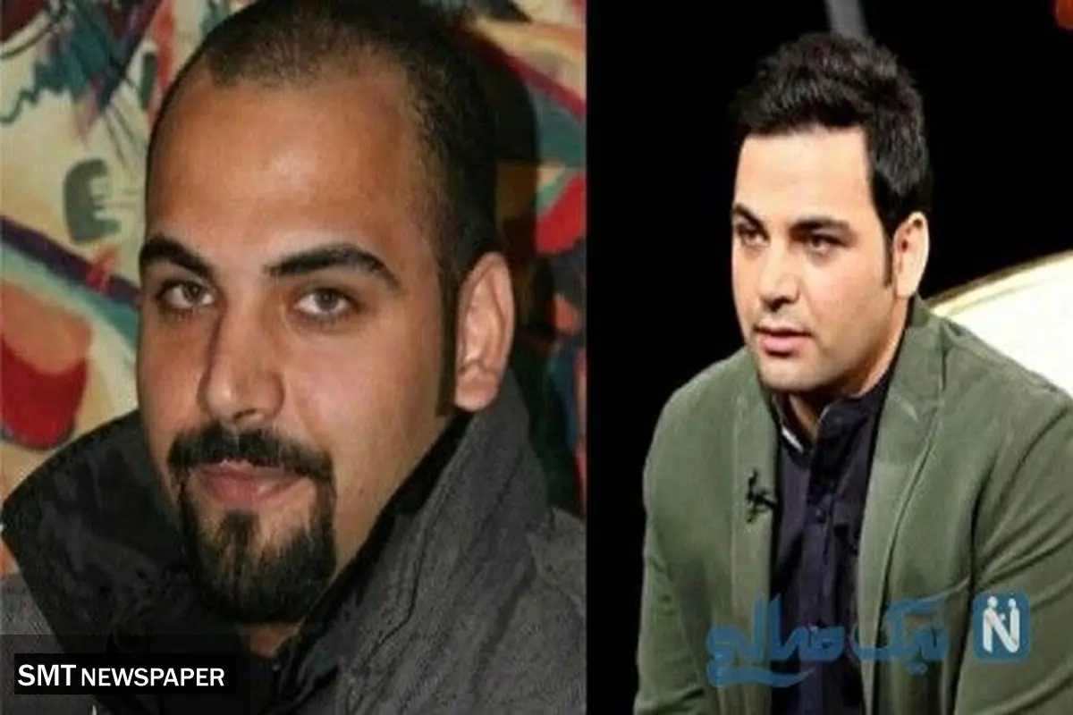 تغییر باور نکردنی احسان علیخانی بعد از کاشت مو جنجالی شد+عکس