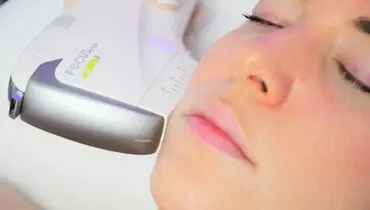 هایفوتراپی صورت برای جوانسازی و کاهش چین و چروک
