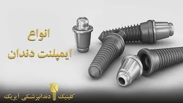 انواع ایمپلنت دندان ( هزینه - مزایا و عوارض)
