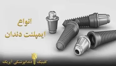 انواع ایمپلنت دندان ( هزینه - مزایا و عوارض)