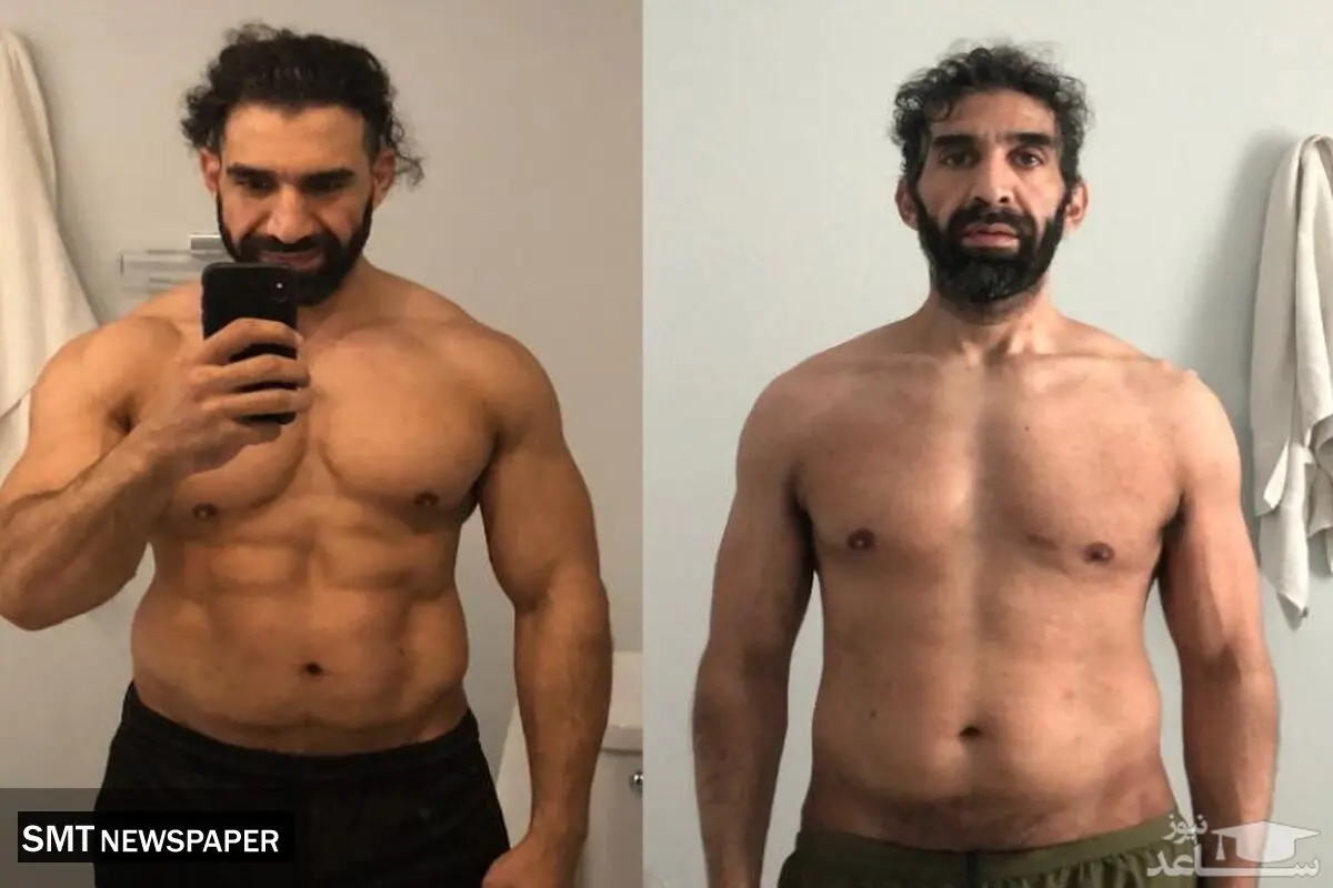 تاثیرات شوکه کننده ی کرونا بر بدن یک ورزشکار+عکس