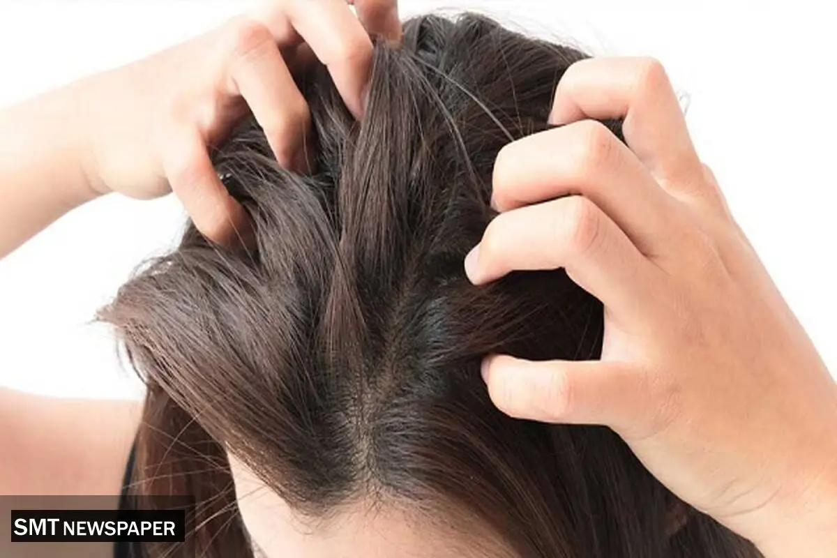 چگونه در تابستان موهای ابریشمی و درخشان داشته باشیم؟
