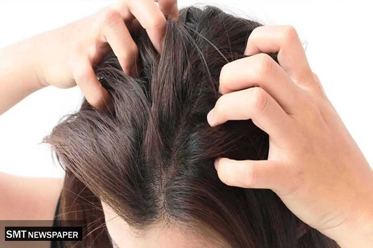 چگونه در تابستان موهای ابریشمی و درخشان داشته باشیم؟