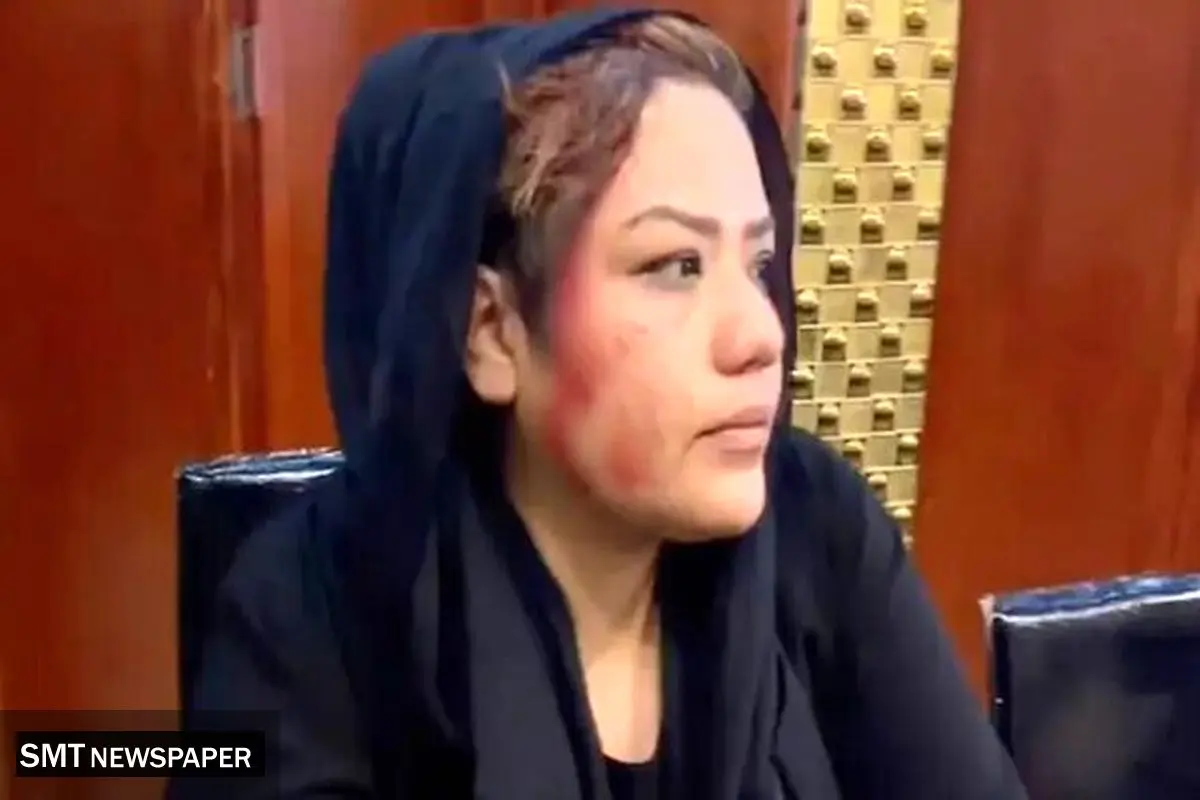 حمله وحشیانه طالبان به زنان افغان + عکس