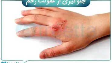بررسی انواع زخم و درمان انواع زخم | ترمیم زخم با محصولات پیشرفته ایرانی تریتا