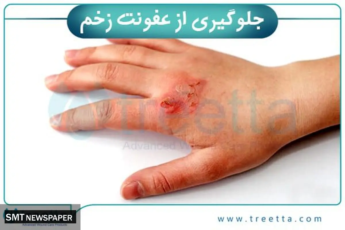 بررسی انواع زخم و درمان انواع زخم | ترمیم زخم با محصولات پیشرفته ایرانی تریتا