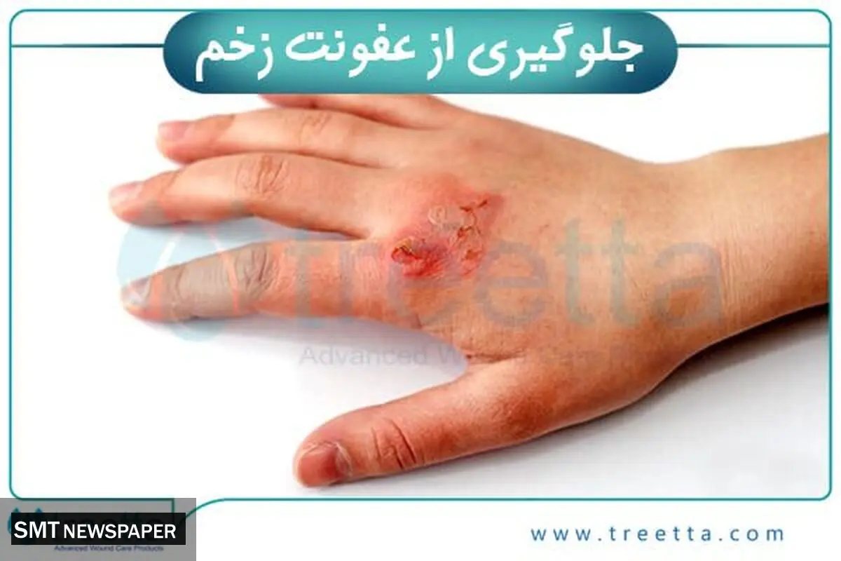 بررسی انواع زخم و درمان انواع زخم | ترمیم زخم با محصولات پیشرفته ایرانی تریتا