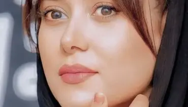 درگیری هولناک پریناز ایزدیار  | پریناز ایزدیار چشم خود را از دست داد؟