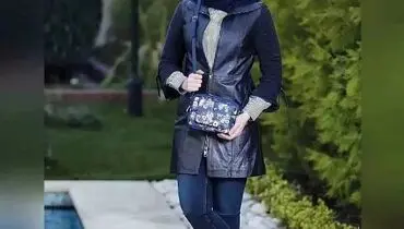 قیافه زشت بهنوش طباطبایی  قبل از عمل | تغیره 180 درجه قیافه بهنوش طباطبایی همه را شوکه کرد 
