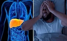 افزایش ریسک مرگ در بیماران کبد چرب با همراهی سه بیماری شایع