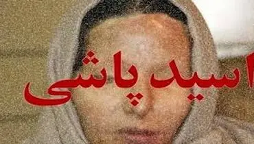 فاجعه اسیدپاشی توسط برادر در مشیریه