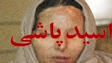 فاجعه اسیدپاشی توسط برادر در مشیریه