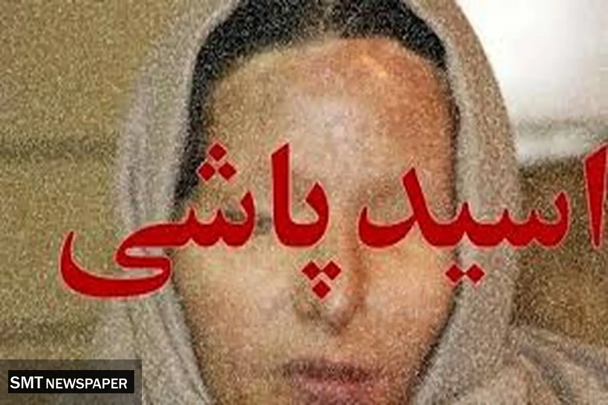 فاجعه اسیدپاشی توسط برادر در مشیریه