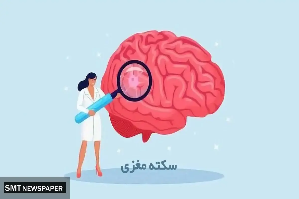 سن سکته مغزی در ایران چقدر است ؟