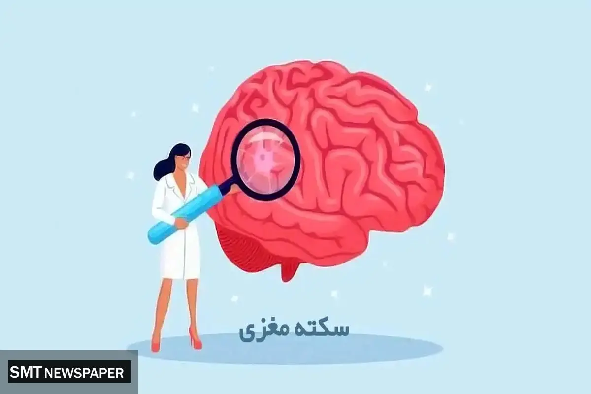 سن سکته مغزی در ایران چقدر است ؟