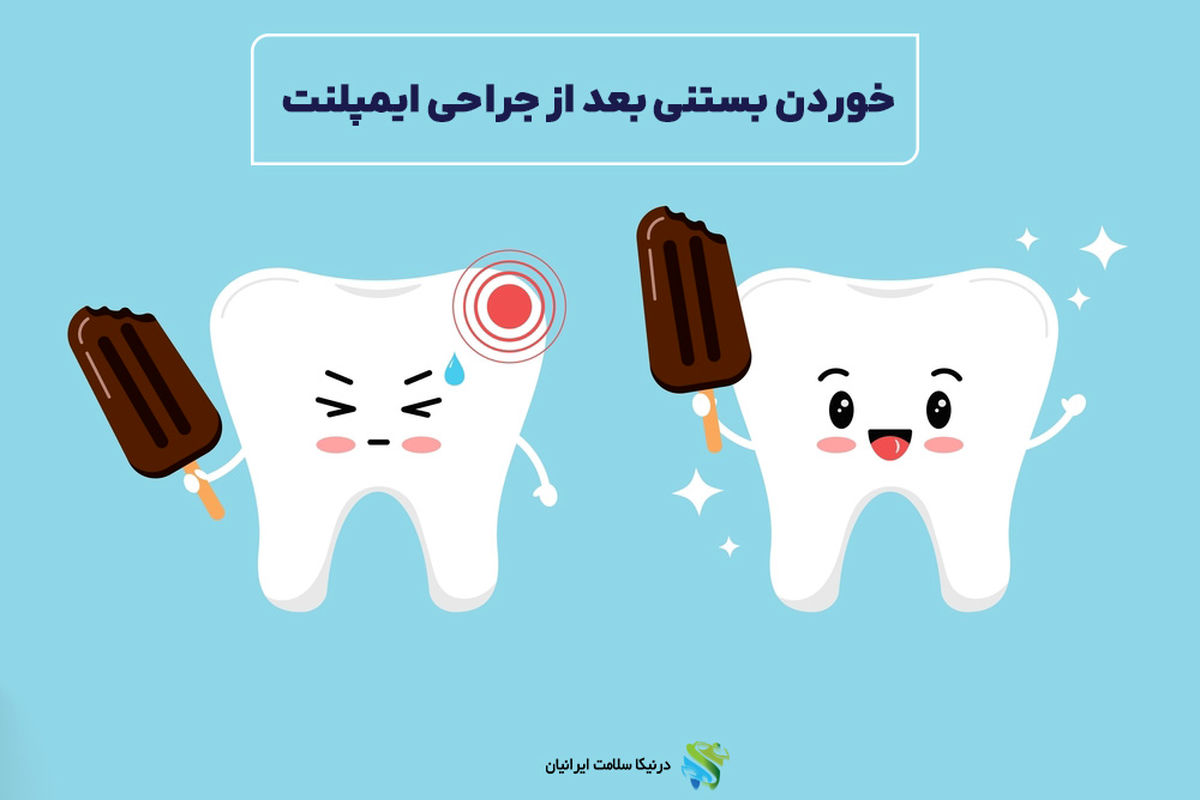 خوردن بستنی بعد از جراحی ایمپلنت