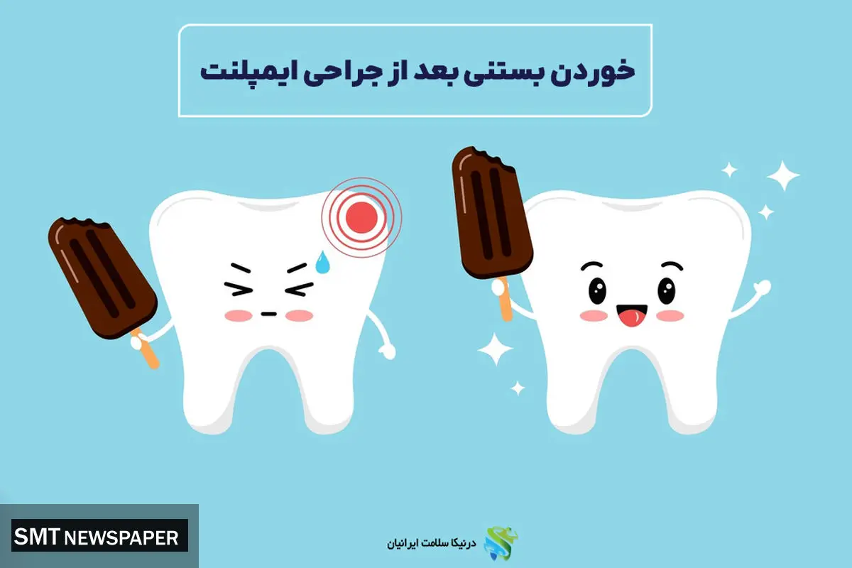 خوردن بستنی بعد از جراحی ایمپلنت