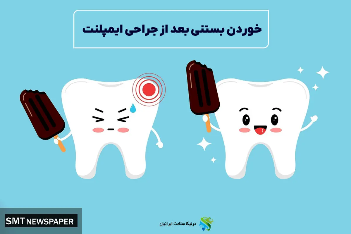 خوردن بستنی بعد از جراحی ایمپلنت