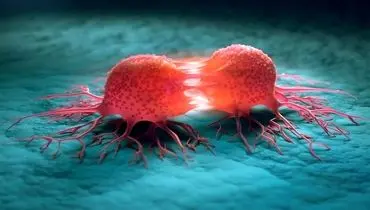 تومور | از شناخت انواع و تشخیص تا انتخاب بهترین جراح