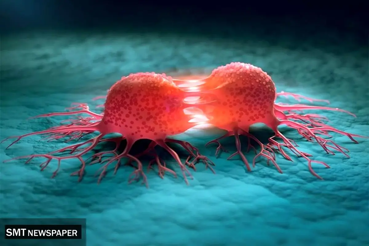 تومور | از شناخت انواع و تشخیص تا انتخاب بهترین جراح