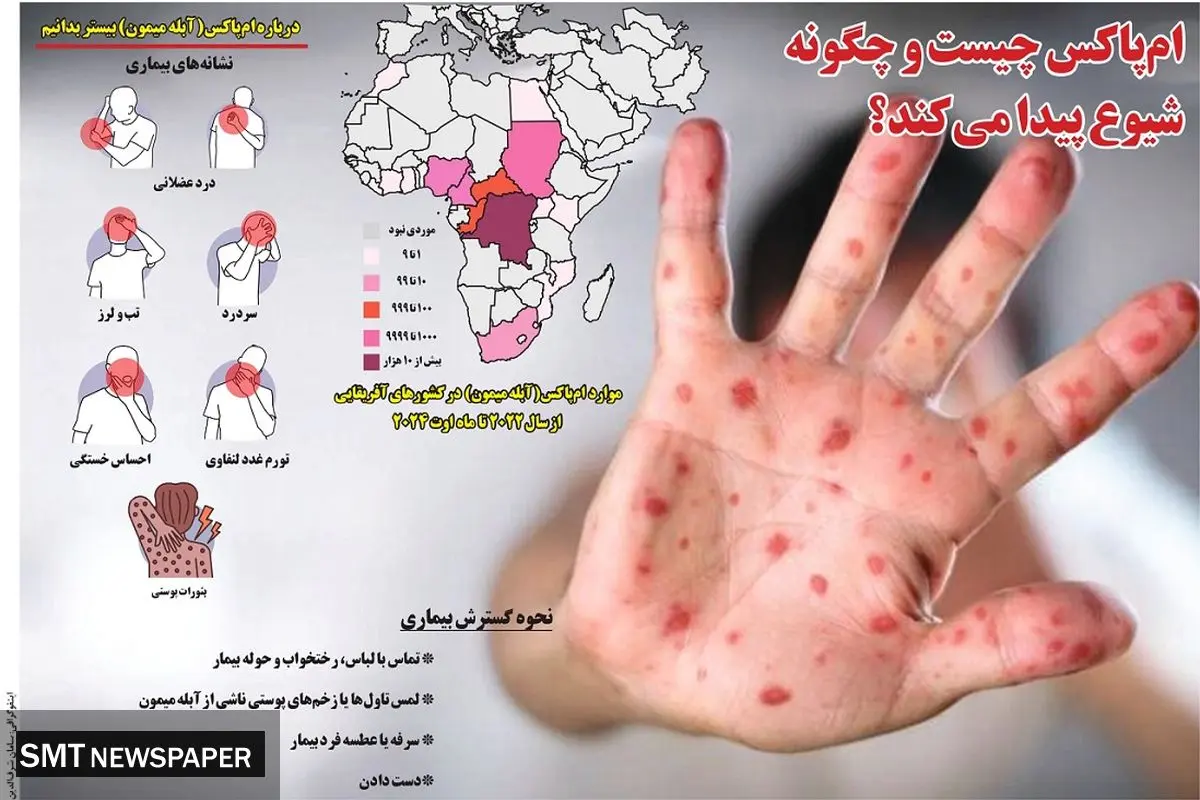 ام پاکس چیست و چگونه شیوع پیدا می کند؟