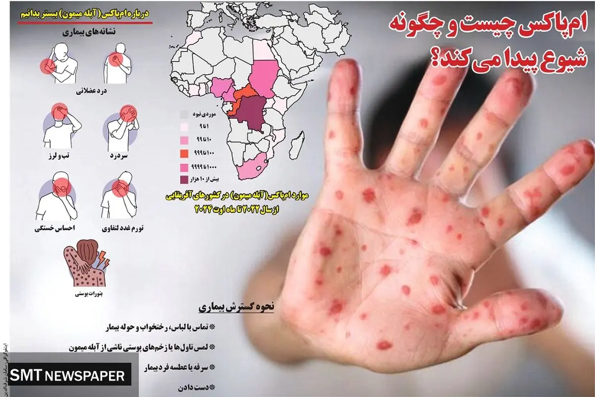 ام پاکس چیست و چگونه شیوع پیدا می کند؟