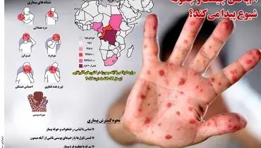 ام پاکس چیست و چگونه شیوع پیدا می کند؟